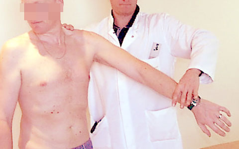 Coiffe Des Rotateurs Degenerative Non Operee Et Reeducation Douleur Info Com